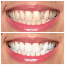 Load image into Gallery viewer, AP24-Whitening Toothpaste-30%+ off
