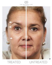 Load image into Gallery viewer, Nu Skin® Facial Spa- SUPER SALE until 1/30!

