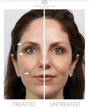 Load image into Gallery viewer, Nu Skin® Facial Spa- SUPER SALE until 1/30!
