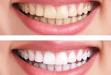 Load image into Gallery viewer, AP24-Whitening Toothpaste-30%+ off
